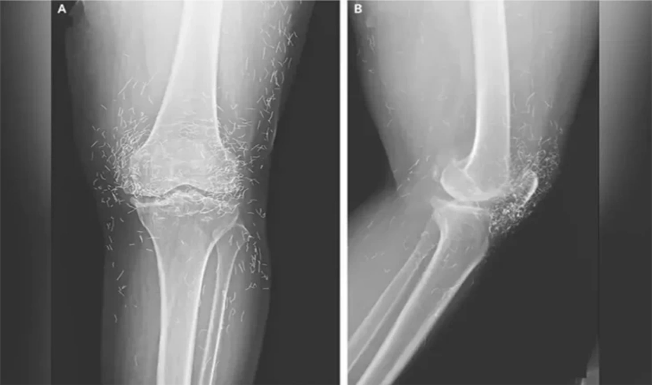 Kasus Medis Viral, Operasi Lutut Ungkap Ratusan Benang Emas